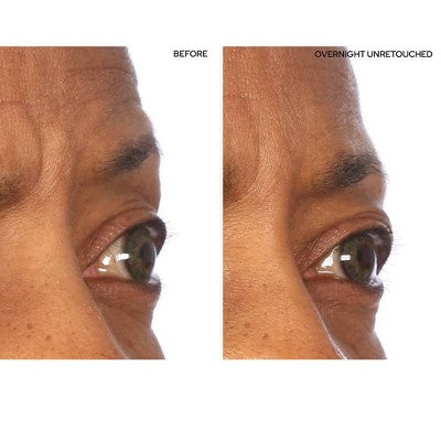 SiO Beauty Super-Lift Pack Brow Eye Smile Patches - New