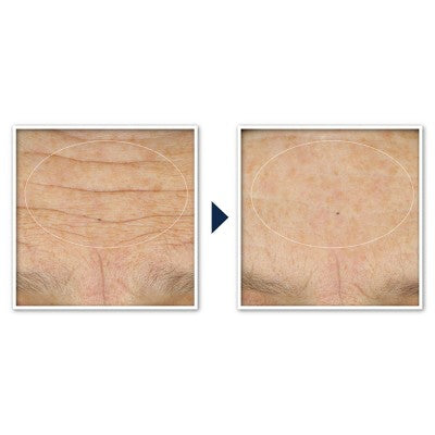 RoC Face & Neck Anti-Aging Moisturizer Firming Cream 1.7 fl oz