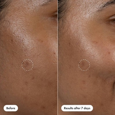 Hero Cosmetics Dark Spot Correct 10ml Serum Pen