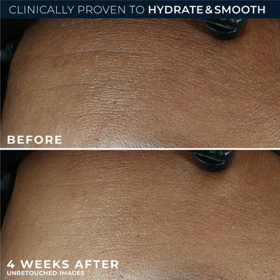 RoC Retinol Correxion Line Smoothing Max Hydration Cream 1.7oz - Missing Box