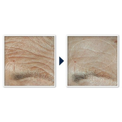 RoC Face & Neck Anti-Aging Moisturizer Firming Cream 1.7 fl oz