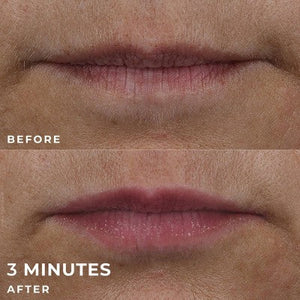 RoC Derm Correxion Lip Volumizer Treatment 0.34 fl oz - Imperfect Box