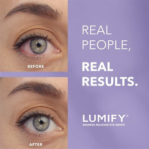 Lumify Eye Drops for Redness Relief 2.5ml - Missing Box