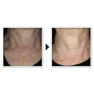 RoC Face & Neck Anti-Aging Moisturizer Firming Cream 1.7 fl oz