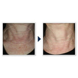 RoC Face & Neck Anti-Aging Moisturizer Firming Cream 1.7 fl oz