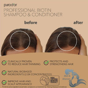 Pura d'or Professional Grade Biotin Conditioner 16 fl oz - Imperfect Container