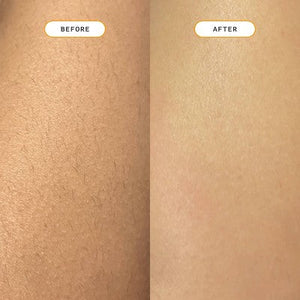 Nood Ingrown Hair Treatment The Eraser - New