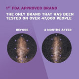 Women's Rogaine 5% Minoxidil Foam for Hair Thinning and Loss, Topical Treatment for Hair Regrowth 2.11oz - New