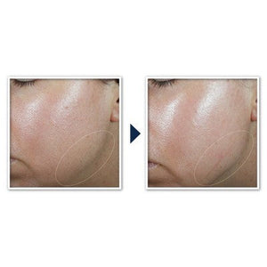RoC Derm Correxion Contour Cream for Face and Neck 1.7oz - Imperfect Box