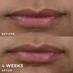 RoC Derm Correxion Lip Volumizer Treatment 0.34 fl oz - Imperfect Box