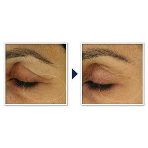 RoC Retinol Correxion Line Smoothing Anti-Aging Wrinkle Eye Cream 0.25oz - Imperfect Box