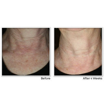 RoC Face & Neck Anti-Aging Moisturizer Firming Cream 1.7 fl oz