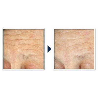 RoC Face & Neck Anti-Aging Moisturizer Firming Cream 1.7 fl oz