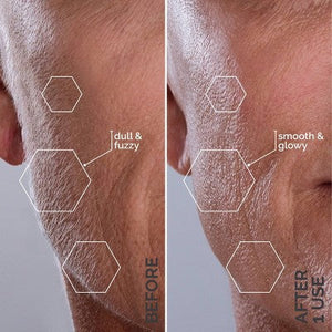 Spa Sciences SIMA Deluxe Sonic Dermaplaning Tool for Exfoliation & Peach Fuzz Removal - Imperfect Box