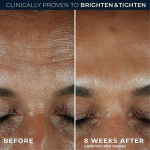 RoC Brightening Anti-Aging Serum with Vitamin C for Dark Spots 1.0 fl oz - Imperfect Box