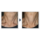 RoC Face & Neck Anti-Aging Moisturizer Firming Cream 1.7 fl oz