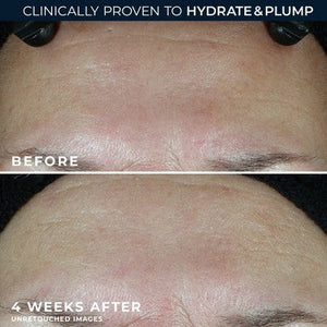 RoC Multi Correxion Hydrate + Plump Daily Moisturizer with Hyaluronic Acid SPF 30 1.7oz - Imperfect Box