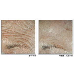 RoC Face & Neck Anti-Aging Moisturizer Firming Cream for Crepey Skin 1.7 fl oz - Imperfect Box