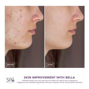 Spa Sciences BELLA 3-in-1 Diamond Tip Microdermabrasion System - Imperfect Box