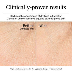 Neutrogena Hydro Boost Water Gel Cream Moisturizer 1.7 fl oz - Imperfect Box